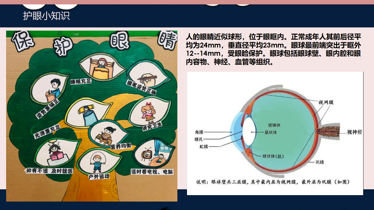 [37]幼儿园大班班本课程《全国爱眼日》23页_17.png