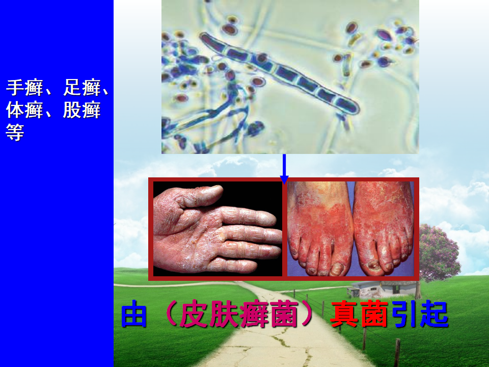 预防传染病课件2_62.png