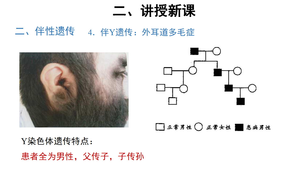 【教学课件】第3节 伴性遗传 示范课件40_30.png