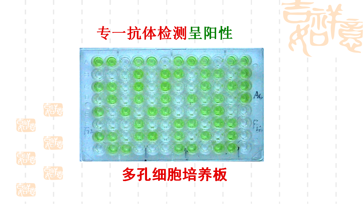 2.2.2 动物细胞融合和单克隆抗体（第二课时） 课件【新教材】2020-2021学年人教版（2019）高二生物选择性必修三_25.png