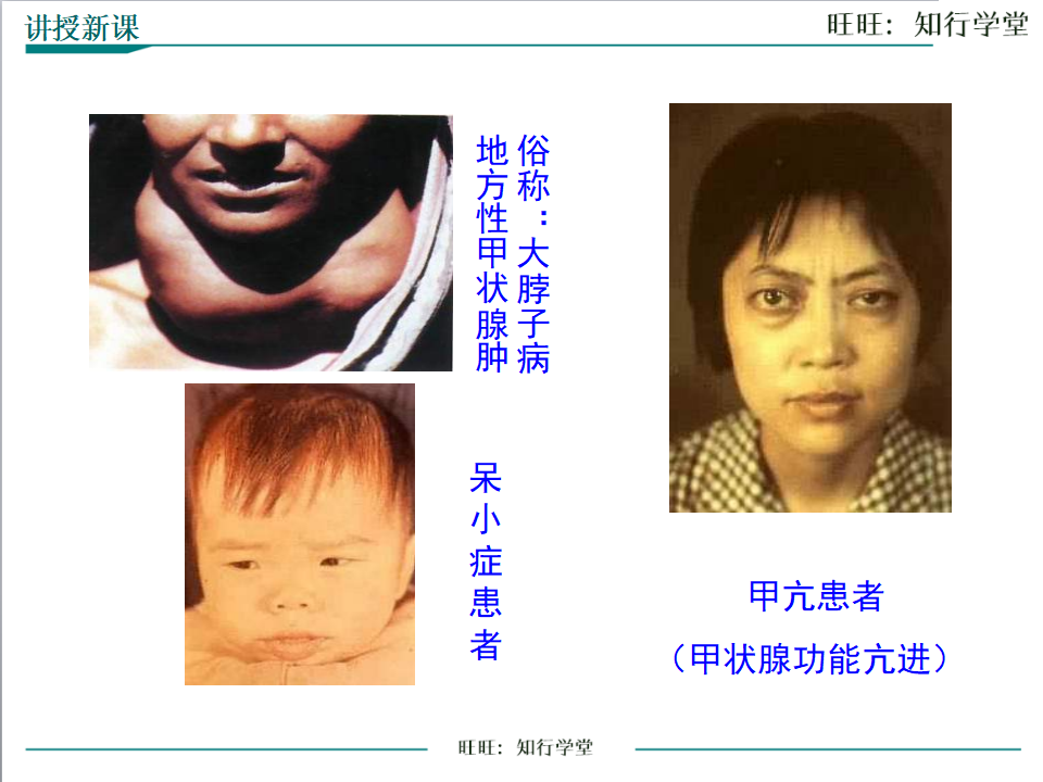 第四节 激素调节_14.png