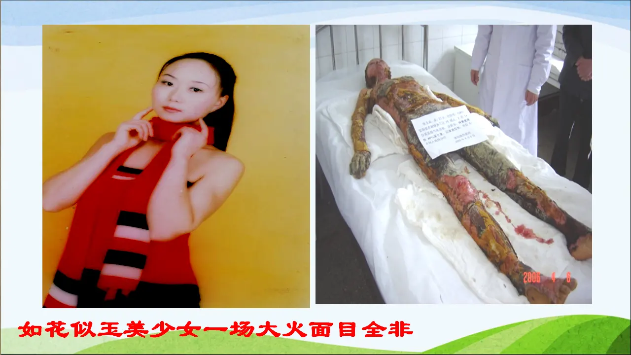 8 安全记心上[杨贵茵]【国家级】（课件4）_05.webp